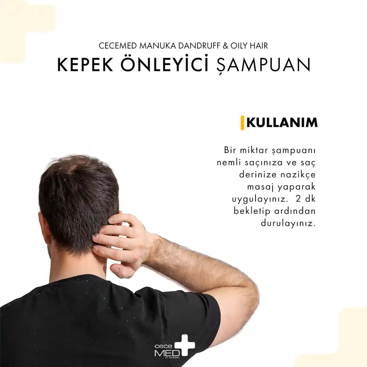 Yağlı Kepek Sorunu ve Etkili Çözüm Yolları Hakkında Kapsamlı Rehber