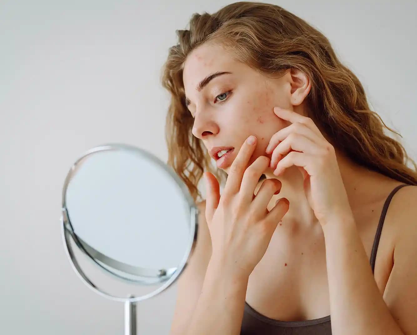 Yağlı ve Sivilceli Ciltler İçin En Etkili Bakım Rehberi ve Uygulama İpuçları