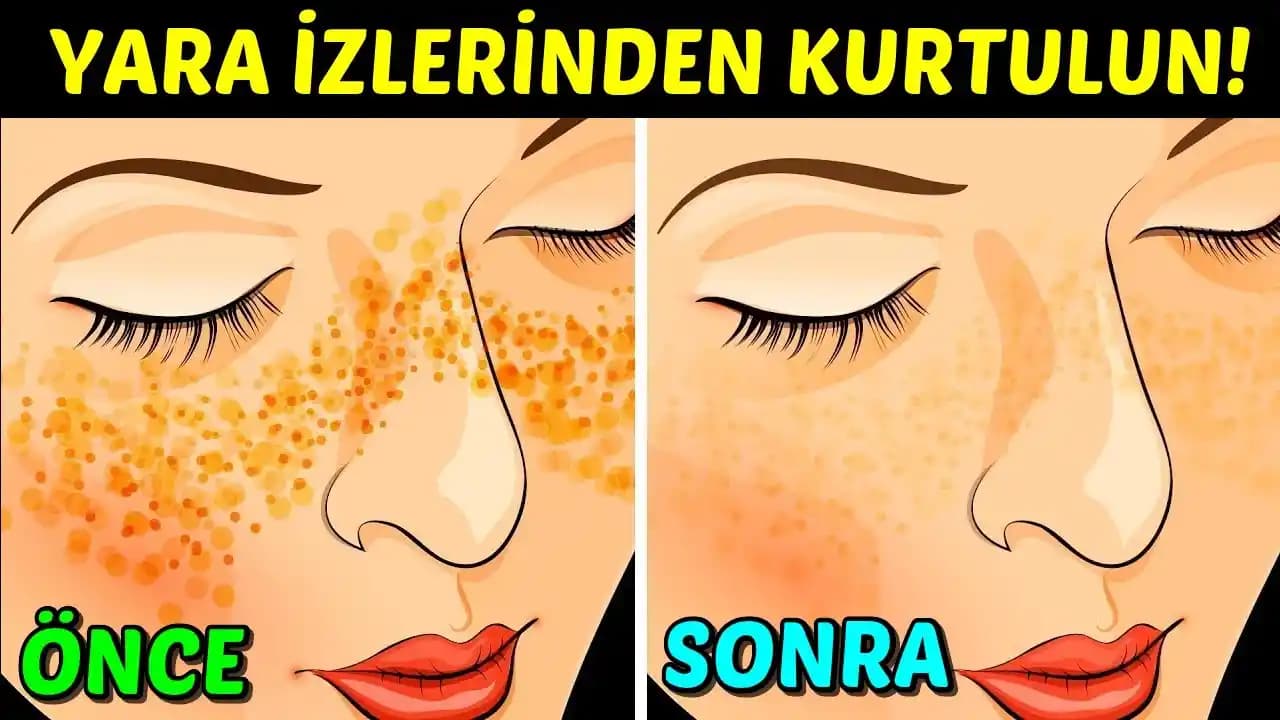 Yüzde Kabuk Atmasına Karşı Etkili Doğal Yöntemler ve Bakım İpuçları