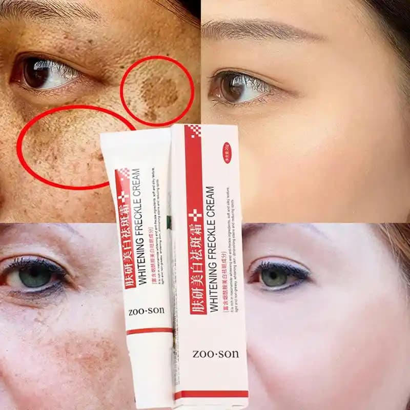 Yüzdeki Pullanma İçin En Etkili Kremler ve Bakım Yöntemleri Hakkında Detaylı Rehber