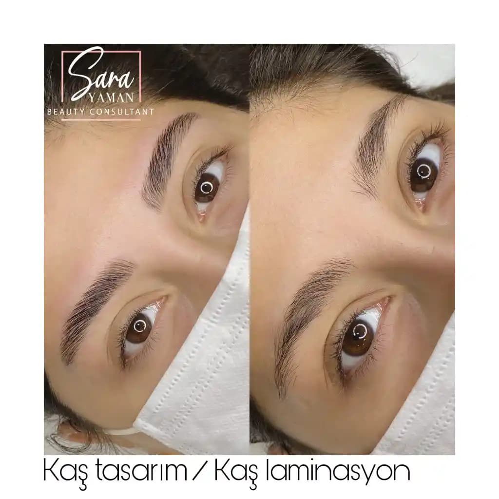 Kaş Laminasyonu Sonrası İlk Günlerde Görünüm ve Bakım Önerileri