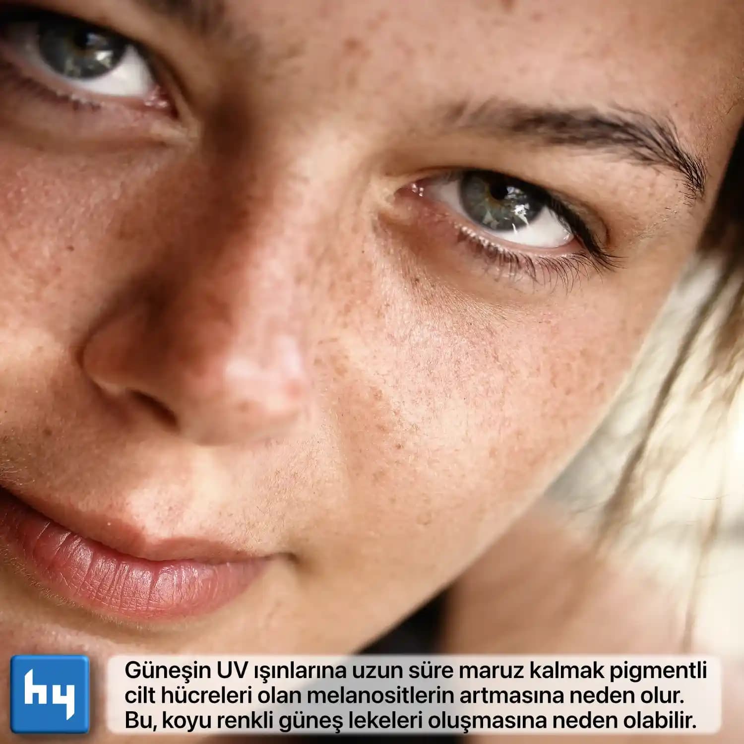 Melanlı Ciltte Yaşlanma Süreci ve Etkili Cilt Bakım Yöntemleri