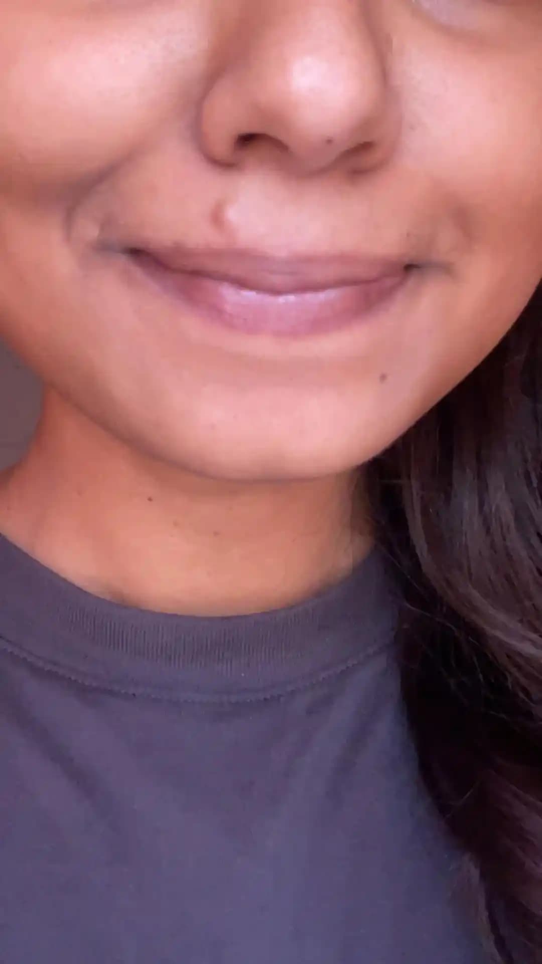 Sebase Kistlerin Alınması: Zamanlama, İzler ve İyileşme Süreci Hakkında Bilmeniz Gerekenler