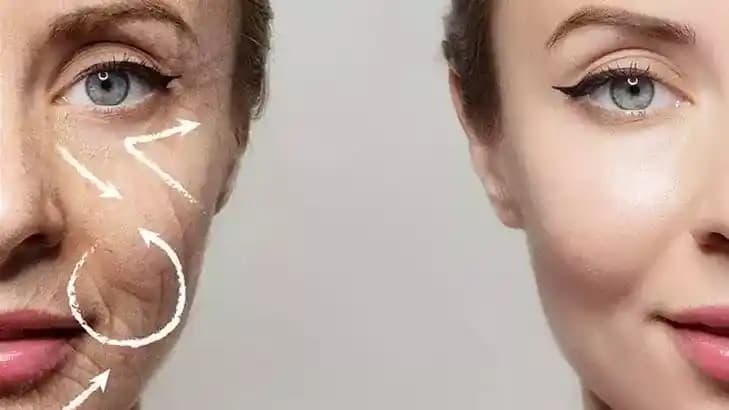 Yaşla İlişkili Yüz Hacmi Kaybında Dolgu Dışında Etkili Alternatif Yöntemler