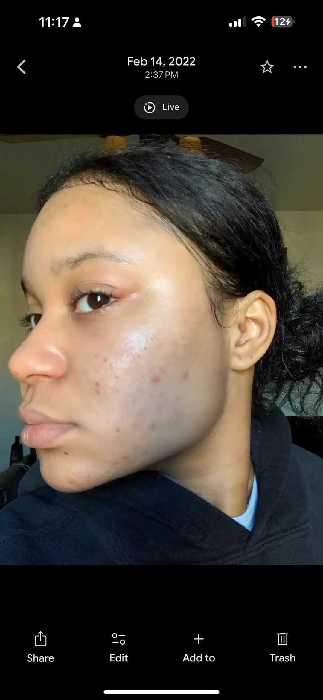 Hasar Görmüş Cilt Bariyerinin Onarımı: 2022-2026 Yılları Arasındaki Değişim ve Bakım Önerileri