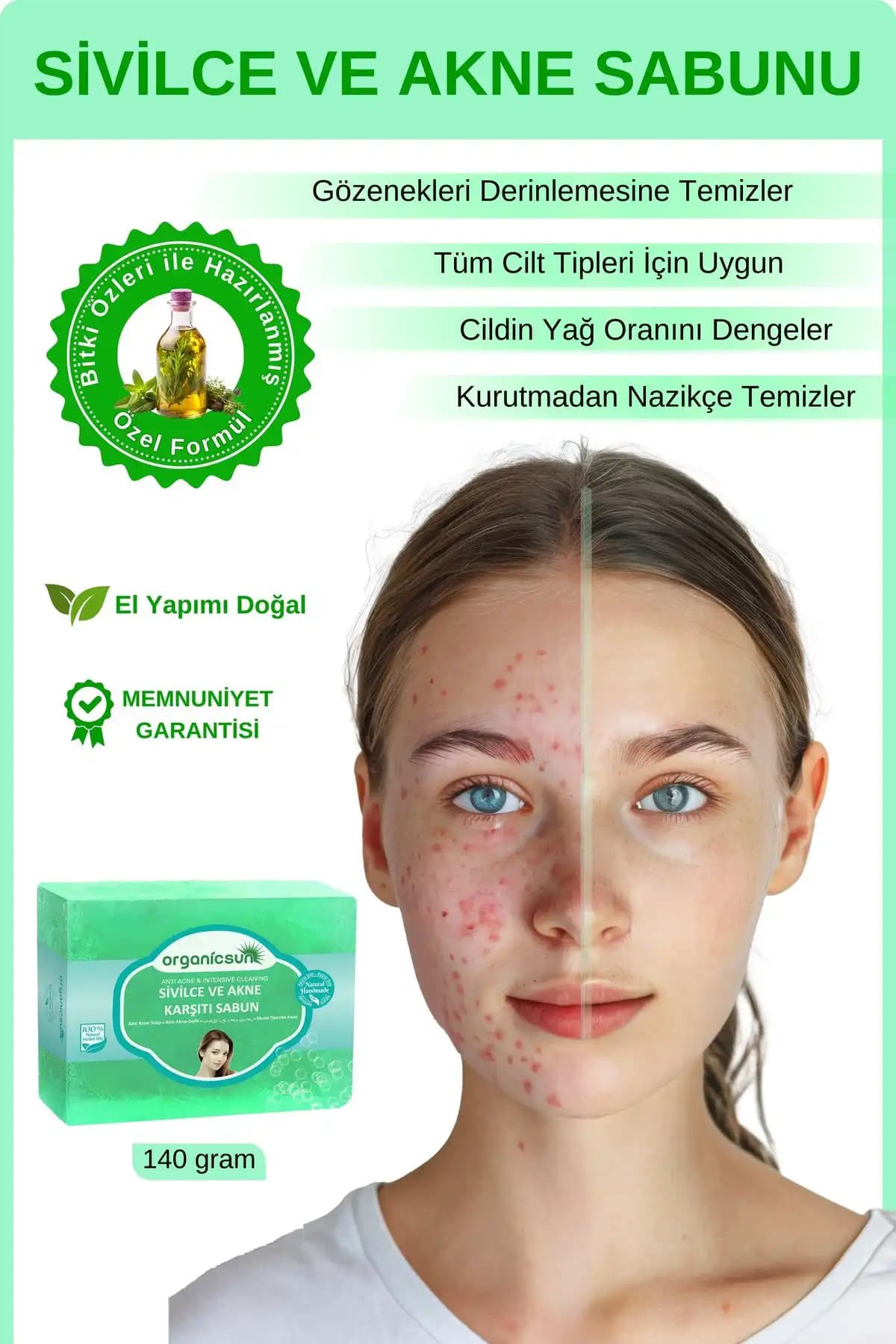 Aytan Home Kükürt Sabunu ve Organicsun Doğal Akne ve Sivilce Sabunu Karşılaştırması 2