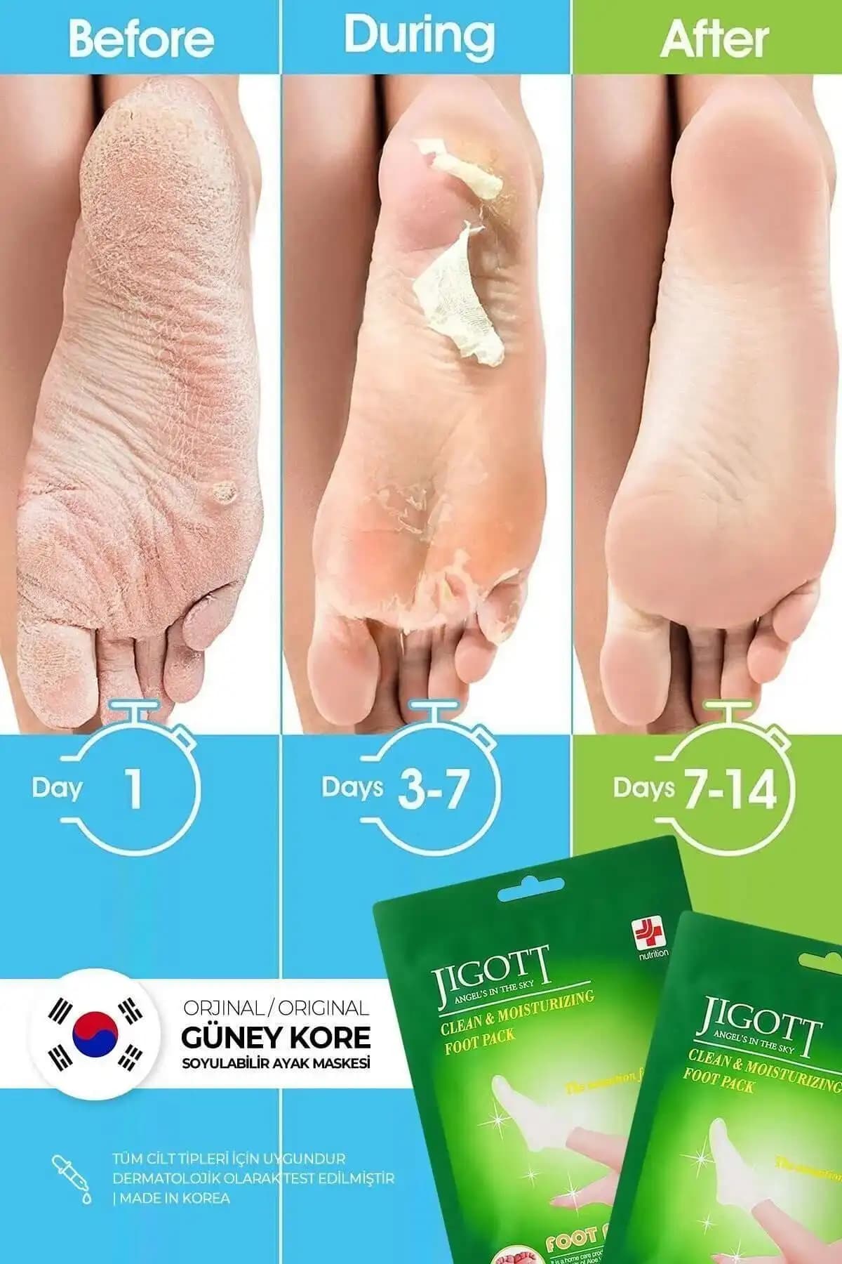 Efero ve Jigott Ayak Peeling Maskeleri Karşılaştırması: Hangi Ürün Daha Etkili 2