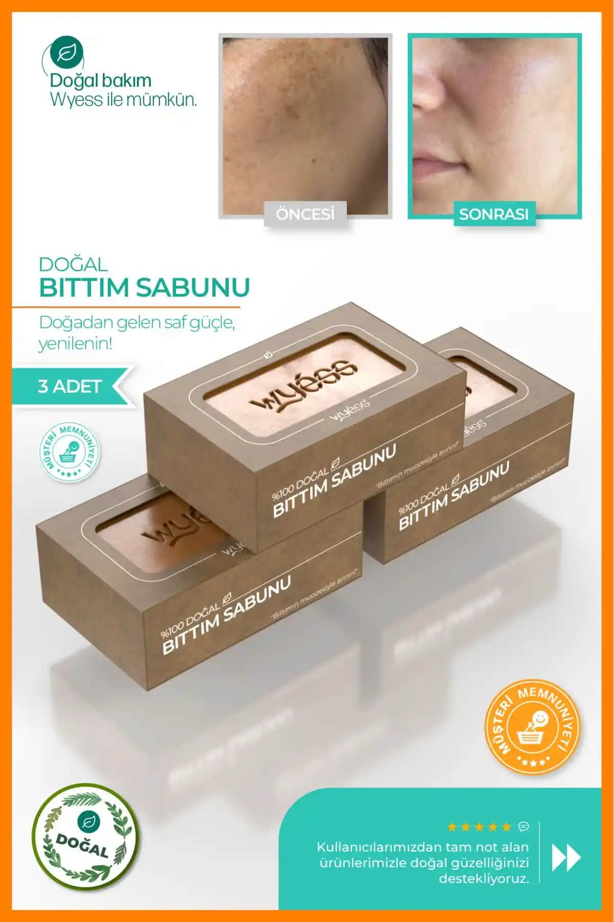 Wyess Doğal Bıttım ve Kabak Lifli Sabunları Karşılaştırması: Cilt ve Saç Bakımında Doğal Seçenekler
