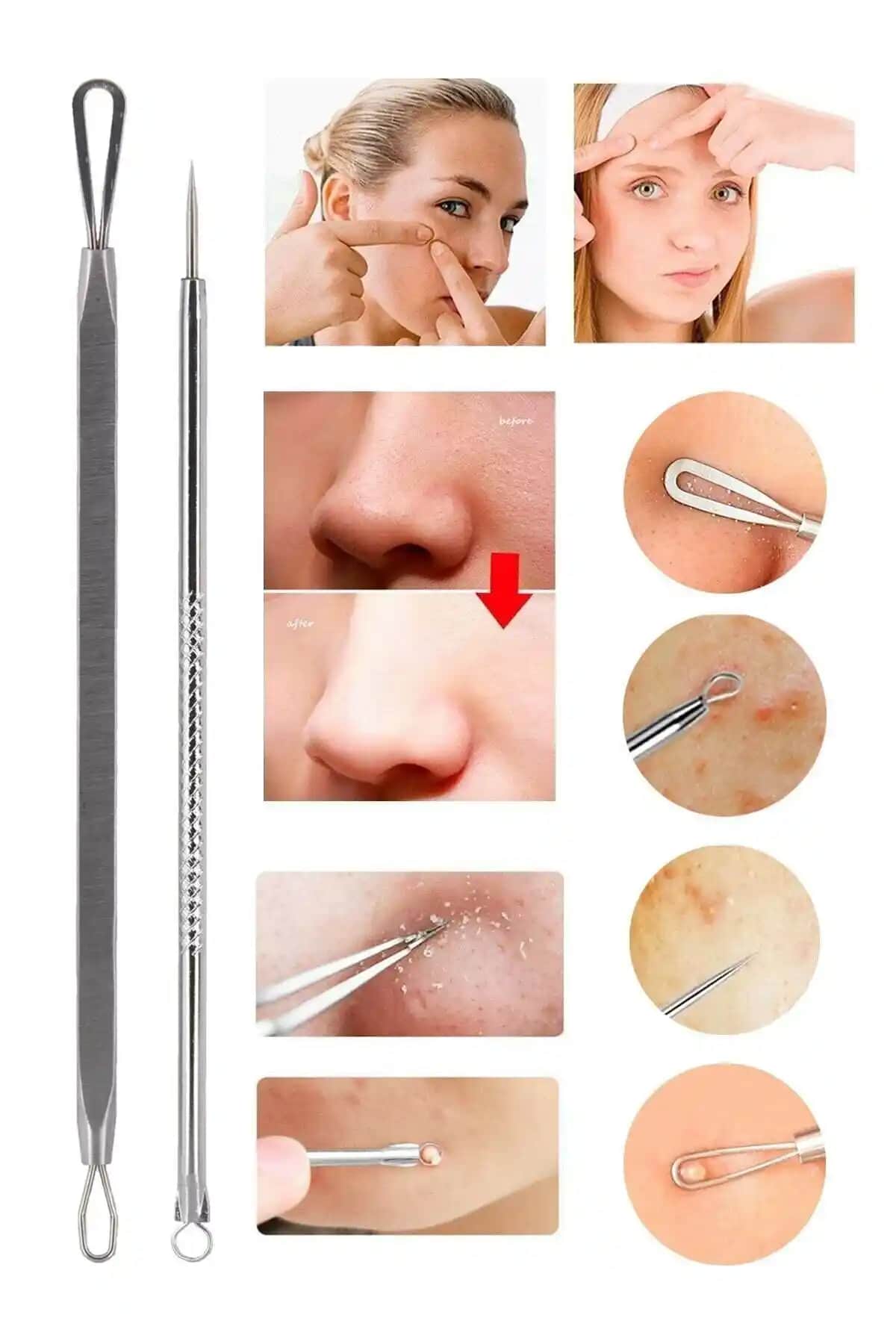 Ocean Akne Siyah Nokta Temizleyici Komedon: Güvenli ve Etkili Cilt Temizleme Çözümü