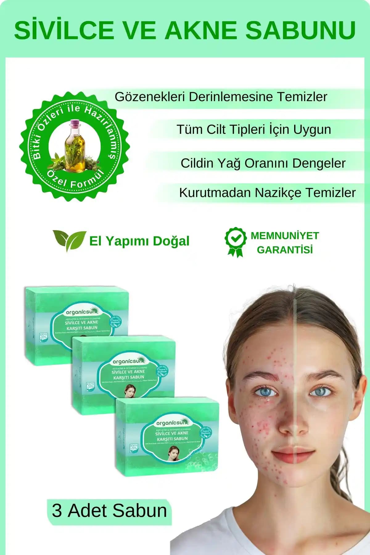 Organicsun Doğal Akne ve Sivilce Karşıtı Sabun: El Yapımı ve Doğal İçeriklerle Güçlü Cilt Bakımı