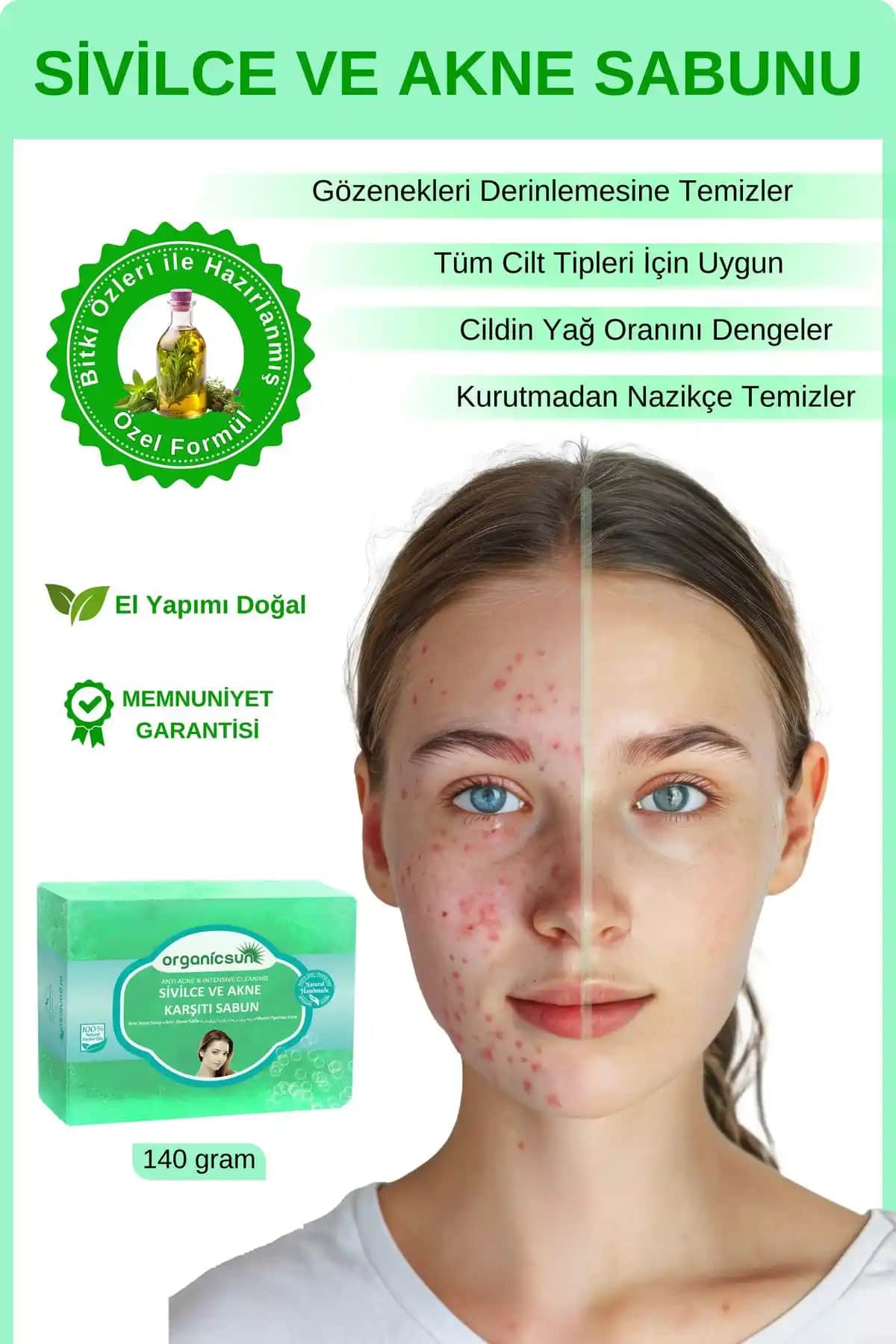 Organicsun Doğal Akne ve Sivilce Karşıtı Sabun ile Sağlıklı ve Parlak Cilt Bakımı