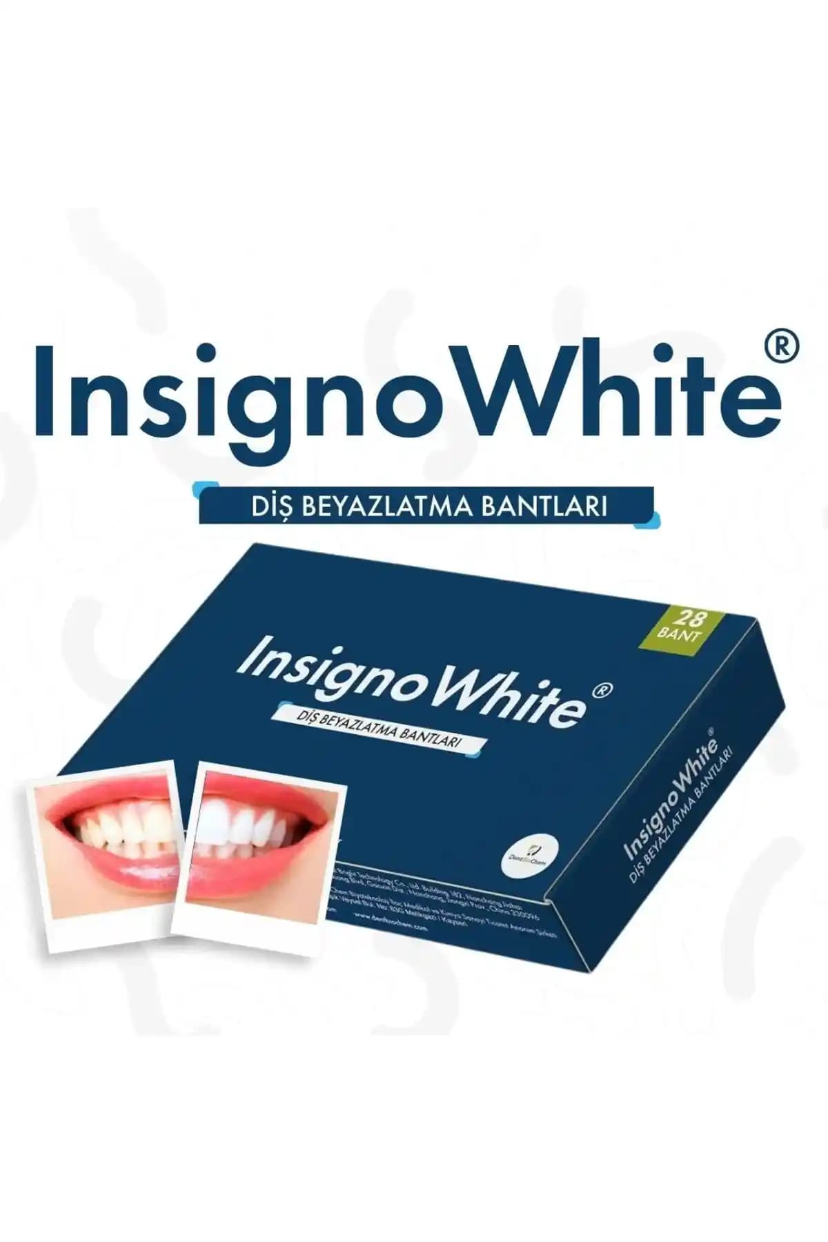 InsignoWhite Diş Beyazlatma Bandı ile Güvenli ve Pratik Gülüş Parlaklığı Artışı