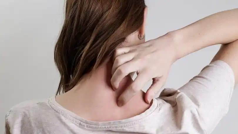 2025 Yılında Alerjik Kaşıntıya Karşı En Güncel ve Etkili Kremler ve Tedavi Yöntemleri