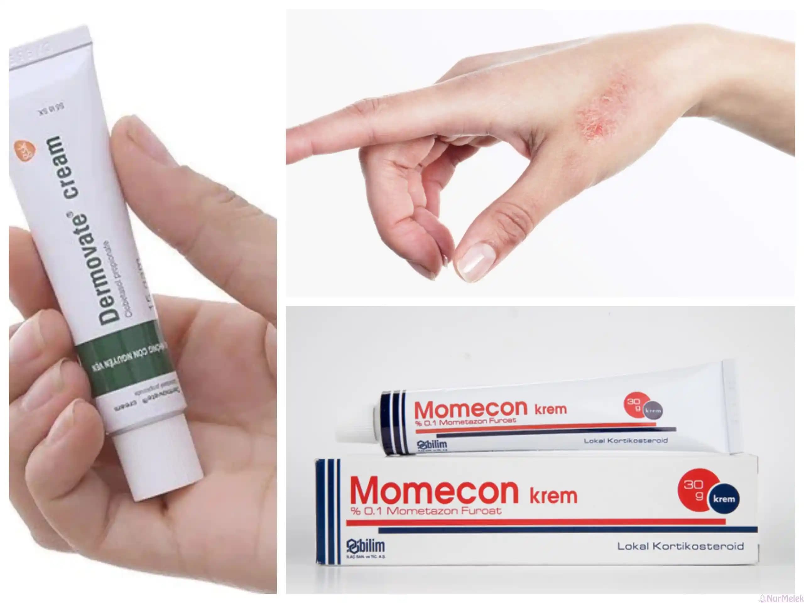 Akne, Sedef ve Yanık Yaraları İçin Güncel Cilt Bakım Yaklaşımları ve Ürünler