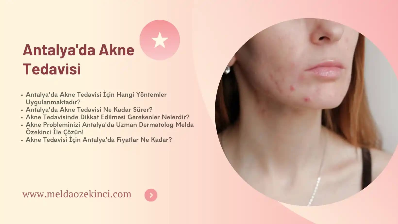 Akne Tedavisinde Güncel ve Kişiye Özel Yaklaşımlar ve Modern Uygulamalar