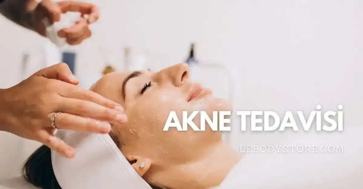 Akne Tedavisinde Güncel Yaklaşımlar ve Yaşam Tarzı Önerileri