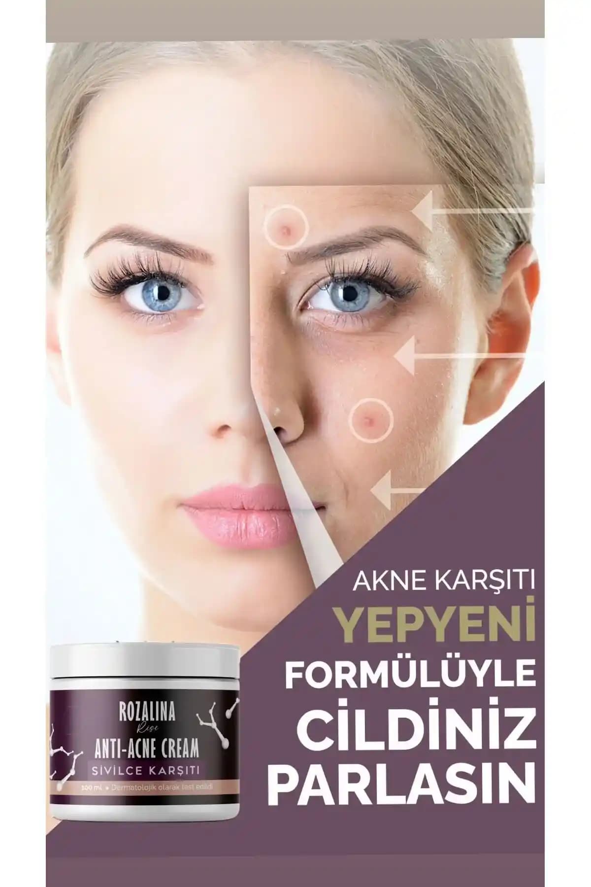 Akne ve Leke Karşıtı Yüz Kremleri: Güncel Formüller ve Kullanım Tavsiyeleri