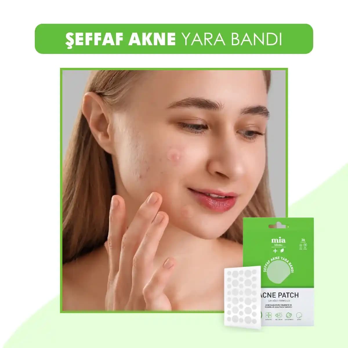 Akne ve Sivilce Bantlarıyla Cilt Bakımında Yeni Yaklaşımlar ve Etkili Kullanım İpuçları