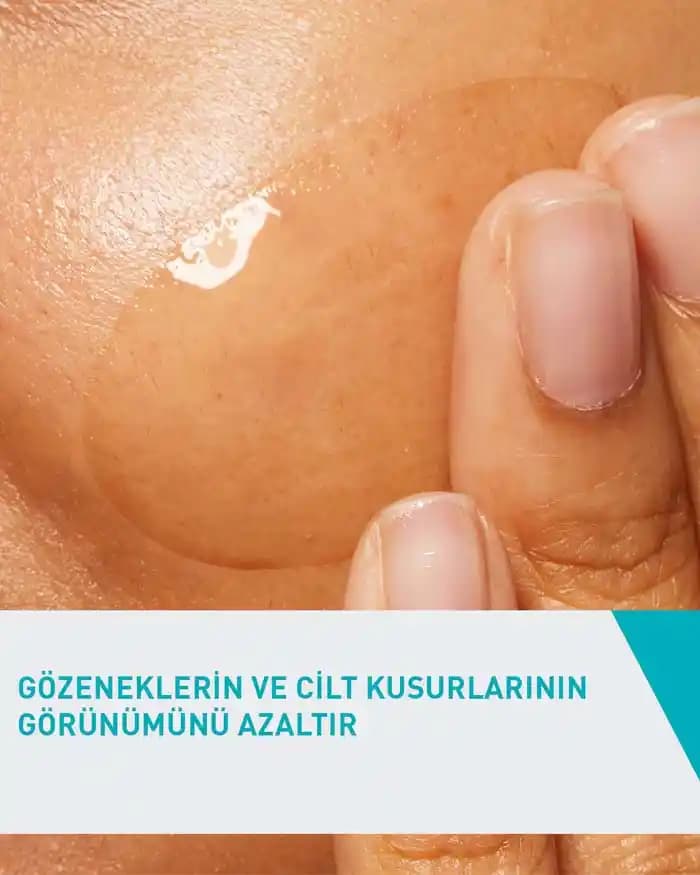 Akneye Eğilimli Ciltler İçin Yüz Jeli: Cilt Sağlığını Destekleyen Temizlik ve Nemlendirme Ürünü