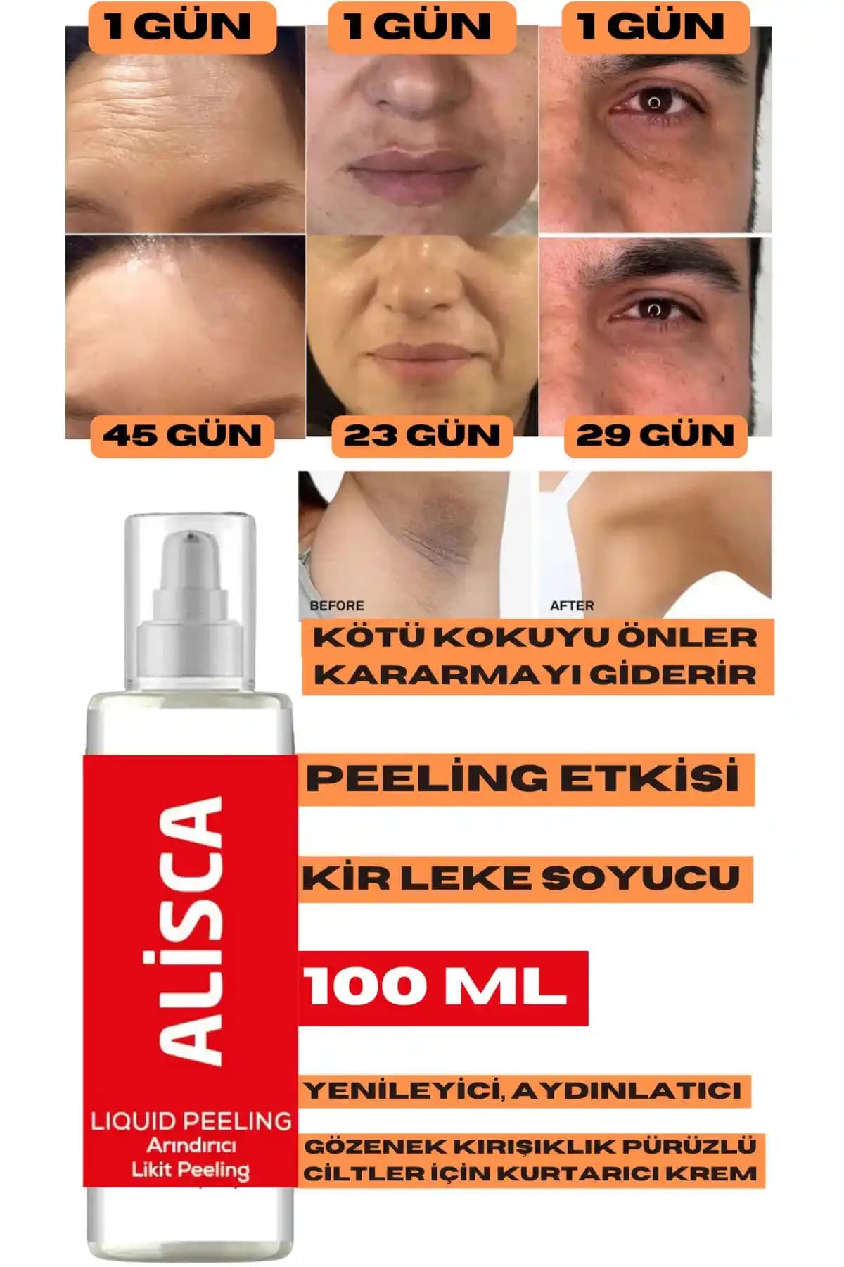 Alisca ve Hozmetic Peeling Ürünleri Karşılaştırması: Hangi Seçenek Sizin İçin Uygun