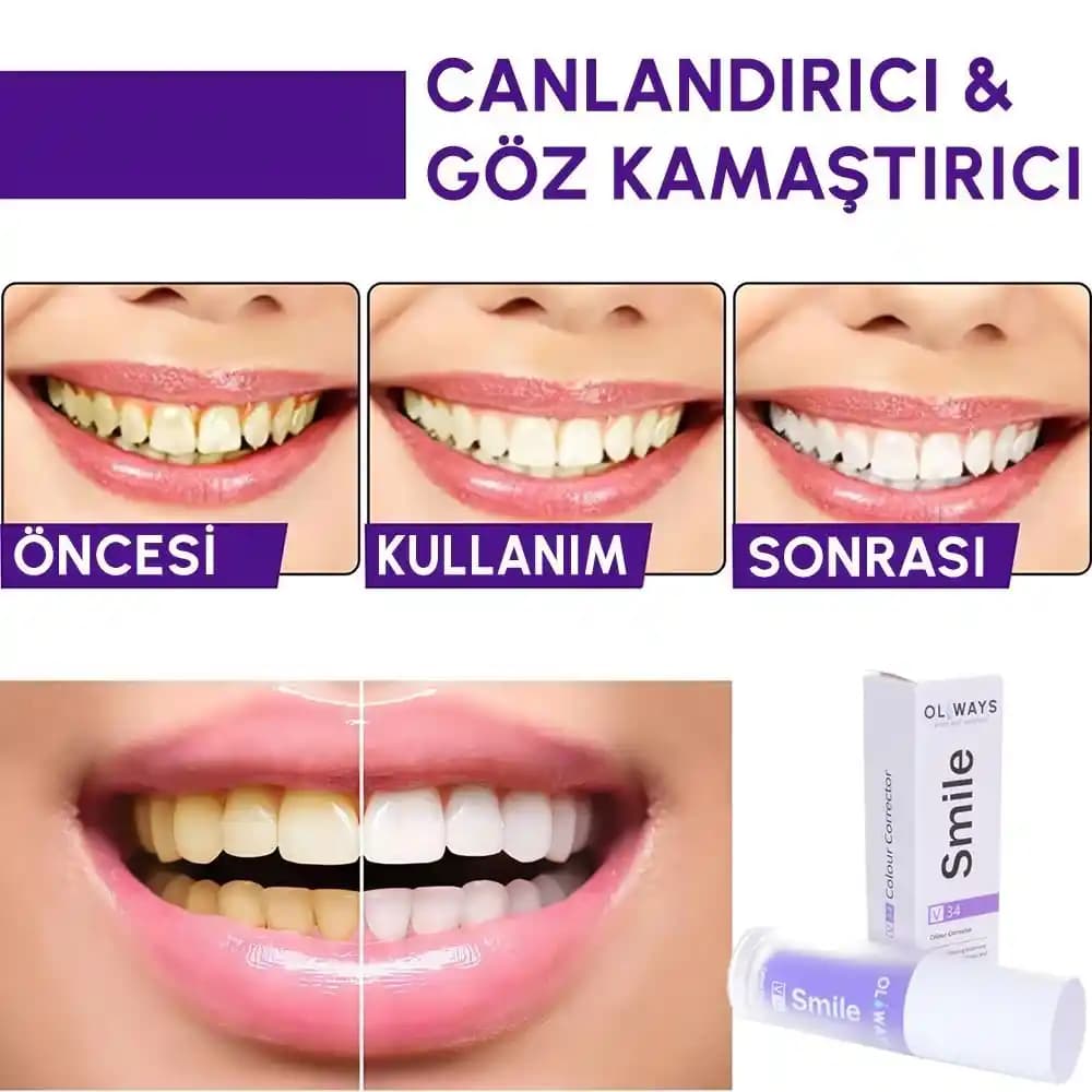 Anında Hızlı Diş Beyazlatıcı Jeller: Etkili ve Güvenilir Seçenekler