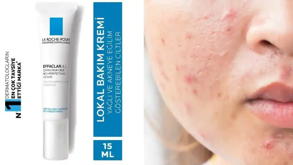 Antibiyotikli Sivilce Kremleri: Kullanımı, Etkileri ve Dikkat Edilmesi Gerekenler