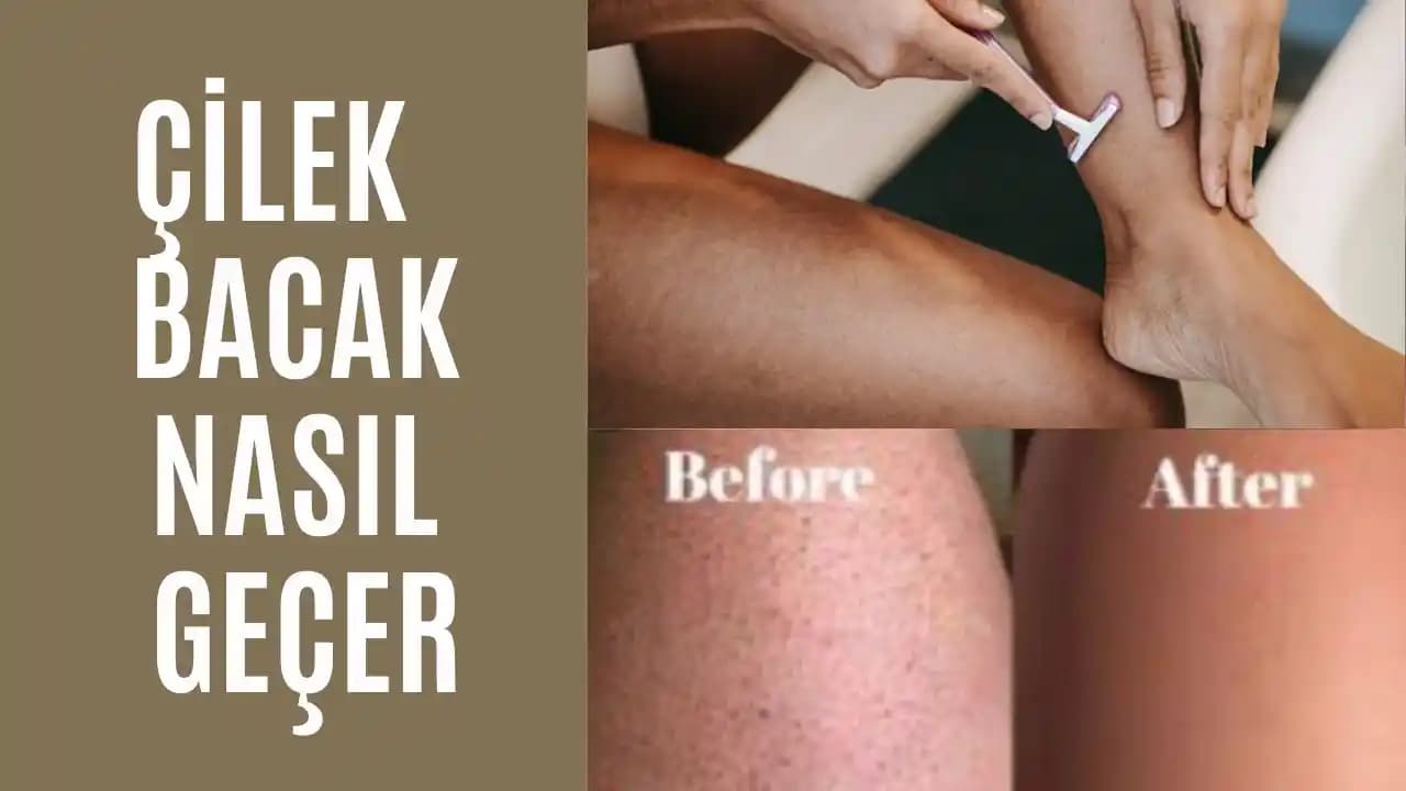 Bacak Peelingi ile Cilt Dokusu İyileştirme Yöntemleri ve Uygulama Tavsiyeleri