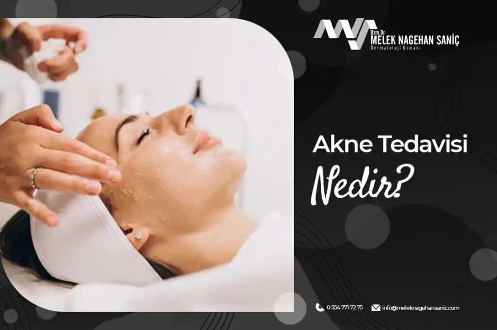 Bebeklerde Akne: Nedenleri, Belirtileri ve Doğru Bakım Yöntemleri Hakkında Bilgiler