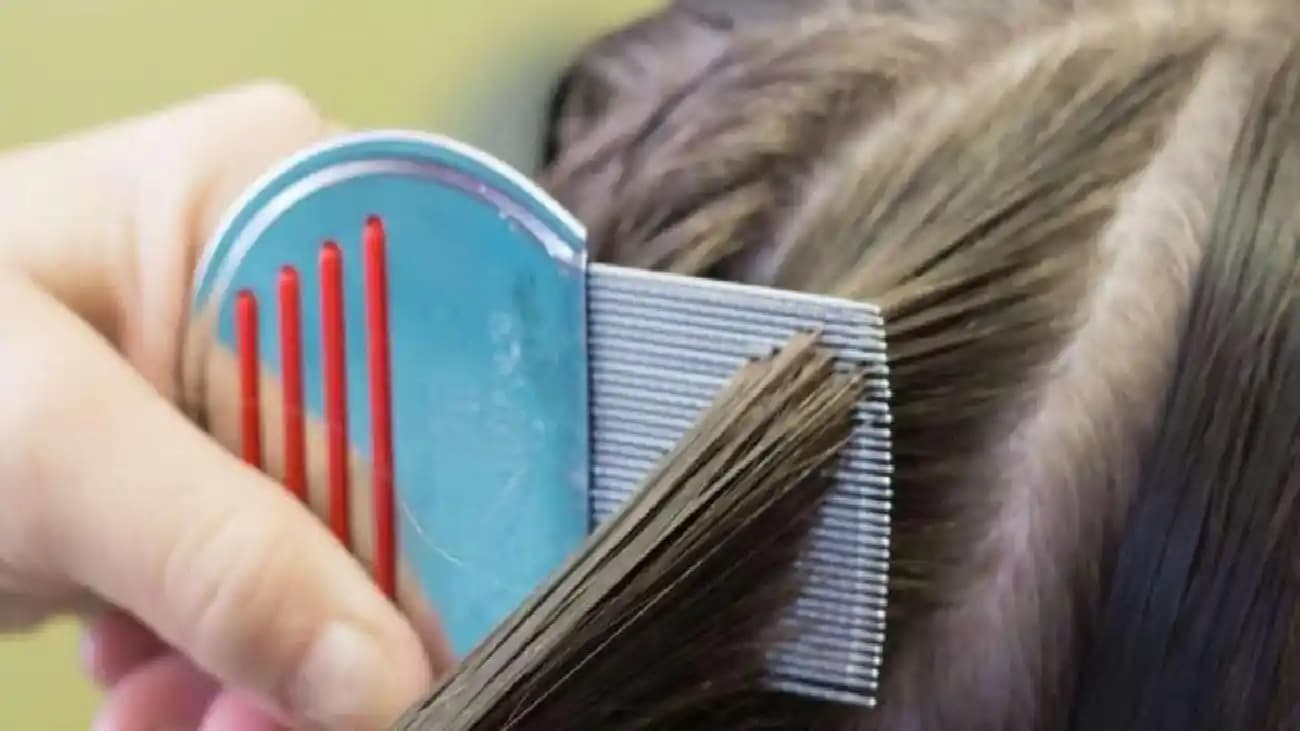 Boyalı Saç ve Saç Dökülmesi: Saç Sağlığını Korumak İçin Bilmeniz Gerekenler