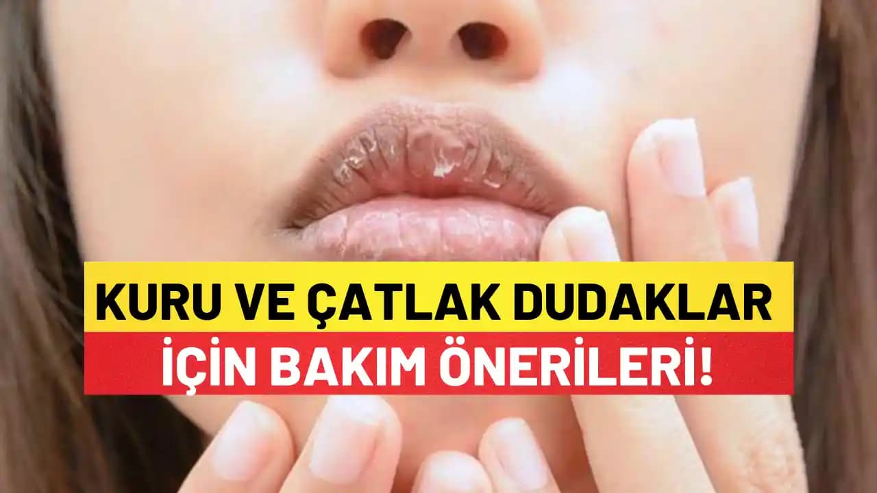 Çatlak Dudaklar İçin Etkili Bakım Yöntemleri ve Koruyucu Önlemler