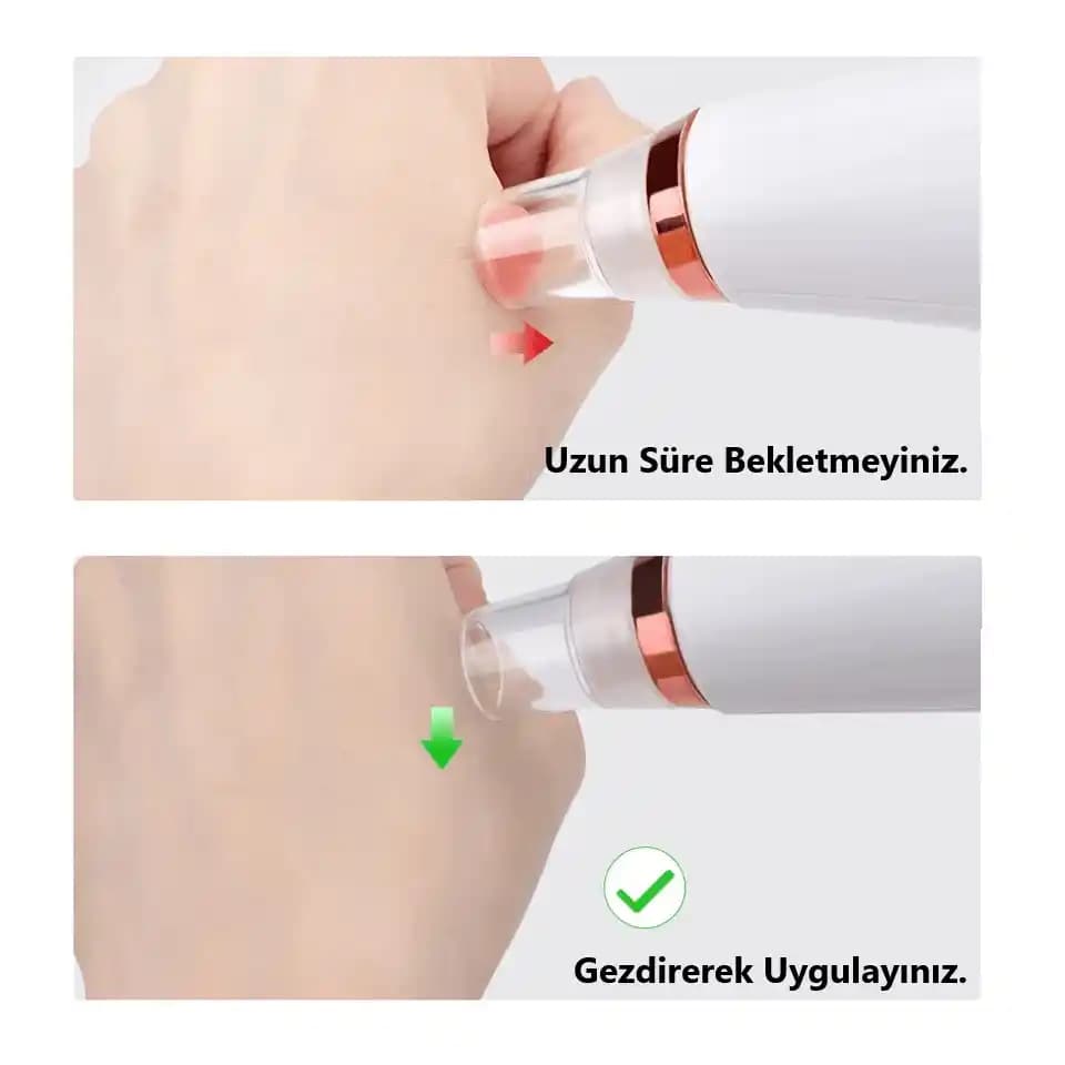 Cilt Bakım Cihazlarıyla Siyah Nokta ve Gözenek Sorunlarına Modern Çözümler