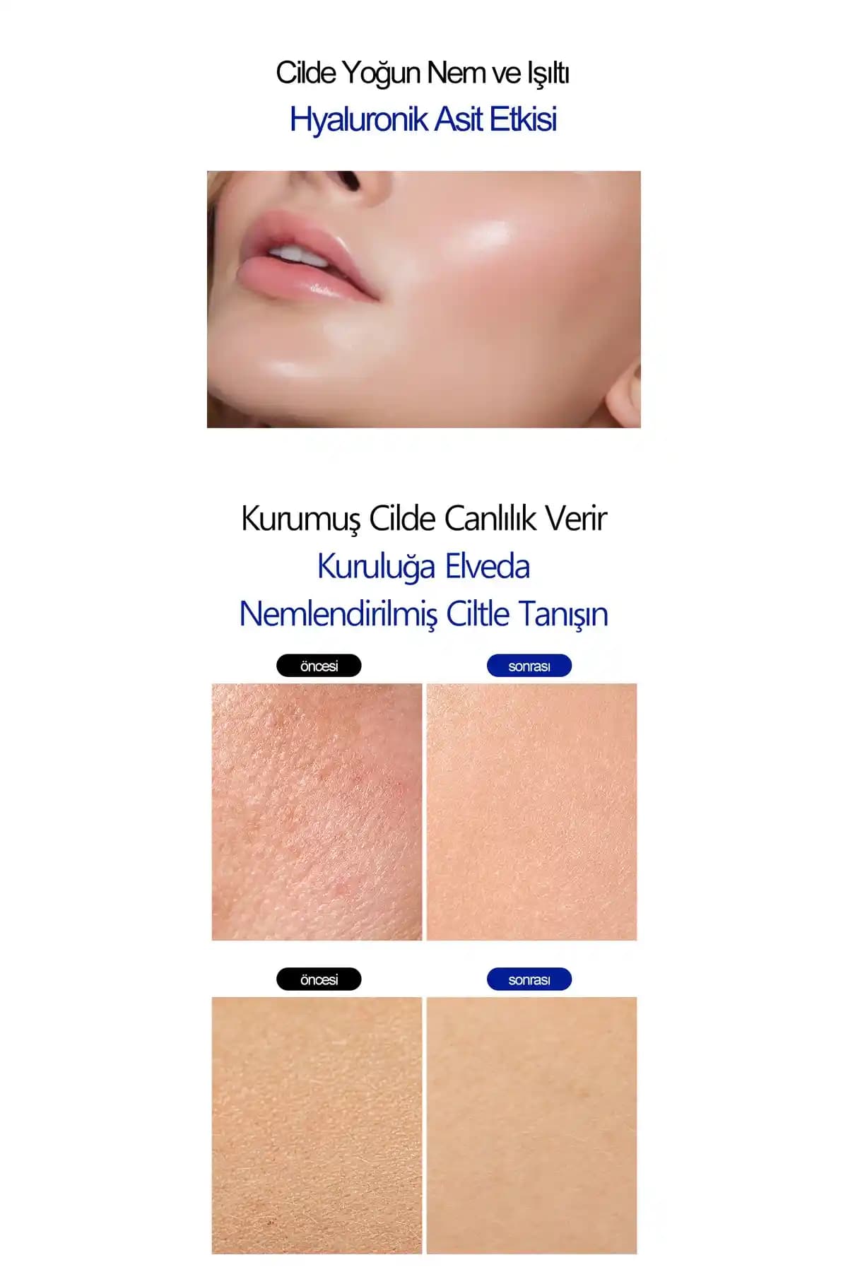 Cilt Elastikiyetini Artıran ve Hassas Ciltler İçin Uygun Ürünler Rehberi