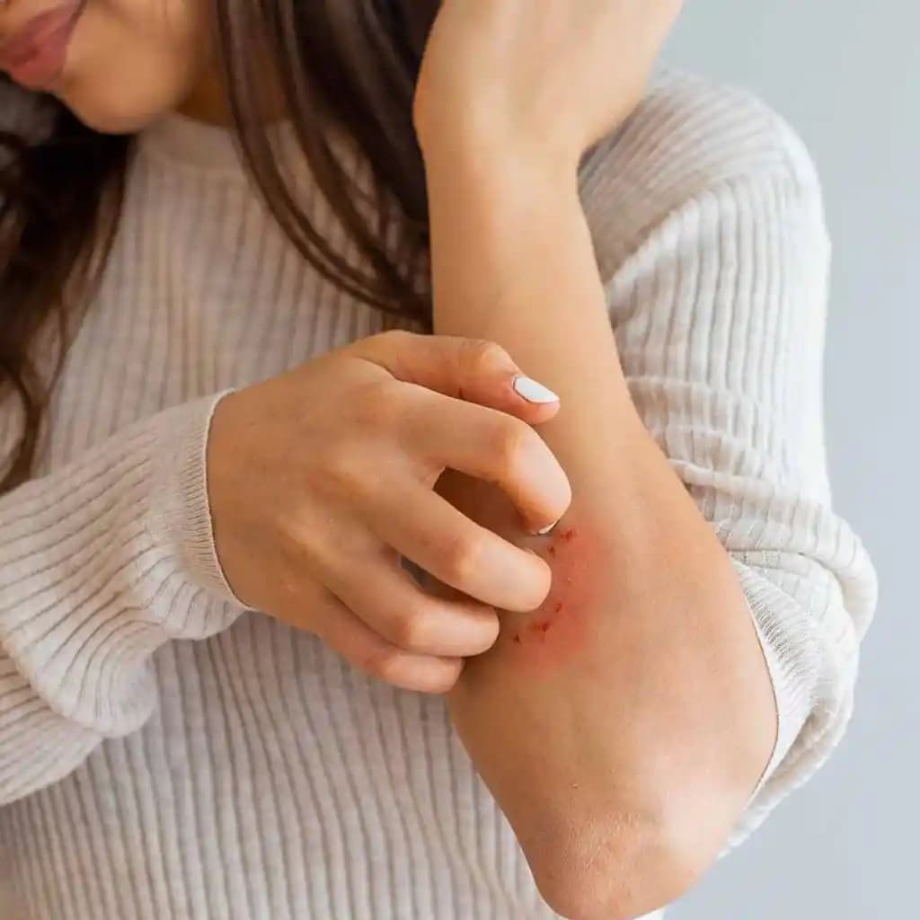 Cilt Sağlığını Koruma ve Kaşıntı Tedavisinde Güncel Yaklaşımlar ve Etkili Yöntemler