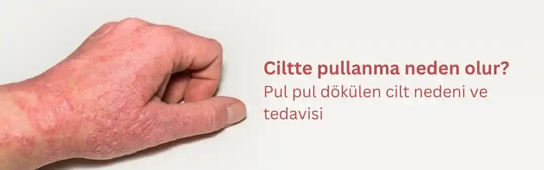 Ciltte Pul Pul Dökülme Nedenleri ve Etkili Çözüm Yolları Hakkında Bilgilendirici Rehber