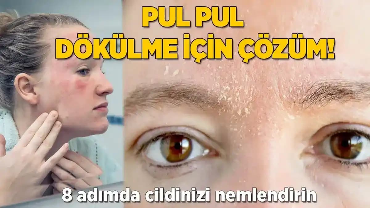 Ciltte Pul Pul Dökülme Nedenleri ve Etkili Çözüm Yolları