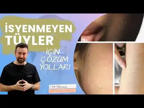 Depilasyon Kremi Kullanımında Cilt Reaksiyonlarının Nedenleri ve Korunma Yöntemleri
