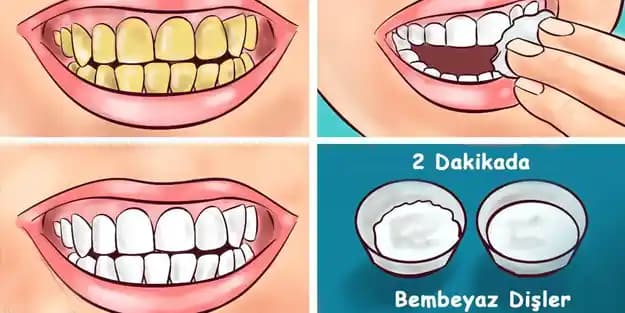 Doğal Diş Beyazlatma Yöntemleri ve Uygulama İpuçları