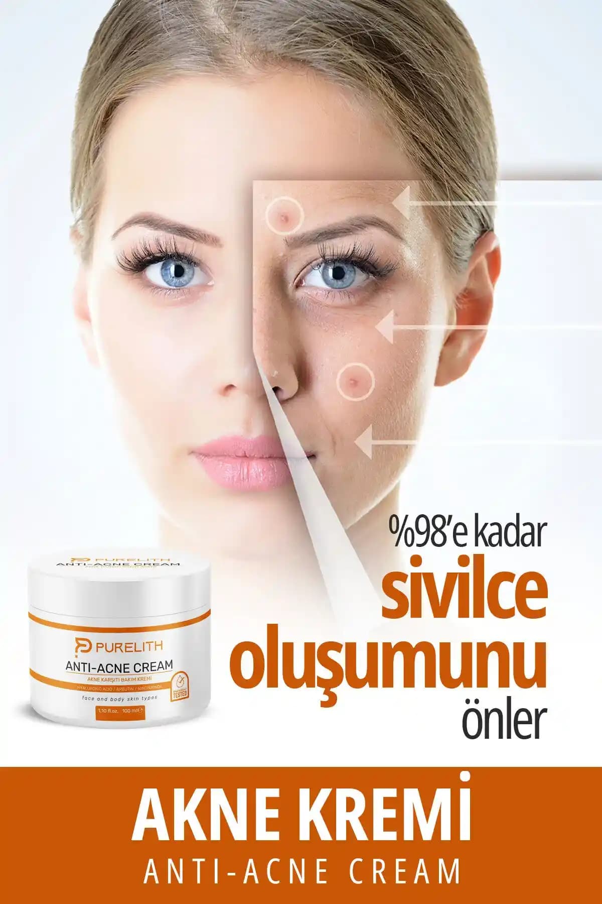 Doğal Sivilce Lekesi Giderici Kremler: Güvenli ve Etkili Çözümler