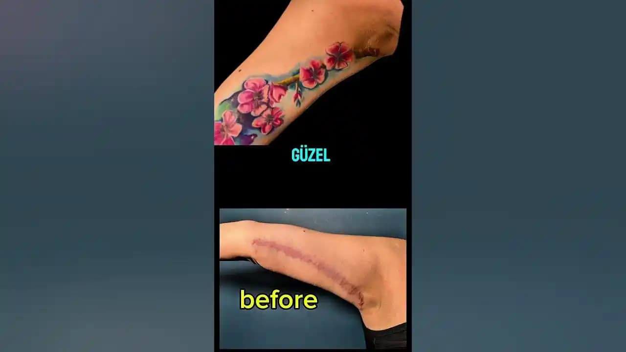 Dövme Sonrası Su Toplaması ve Enfeksiyon Risklerini Önleme Yöntemleri