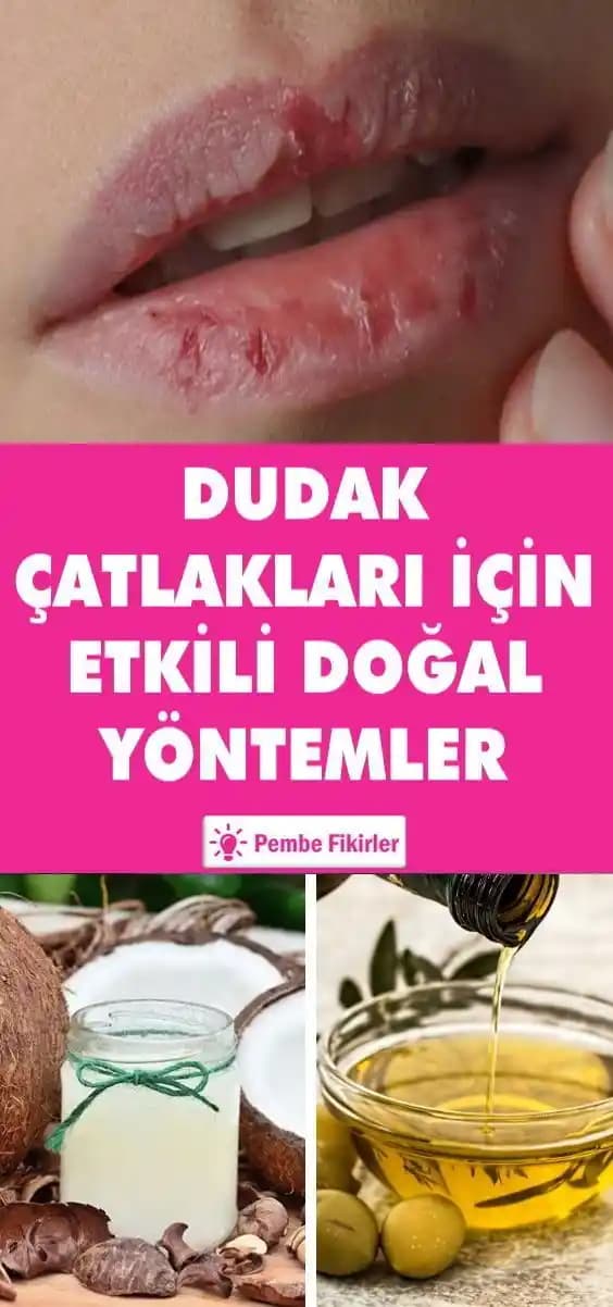 Dudak Çatlaklarının Nedenleri ve Etkili Tedavi Yöntemleri