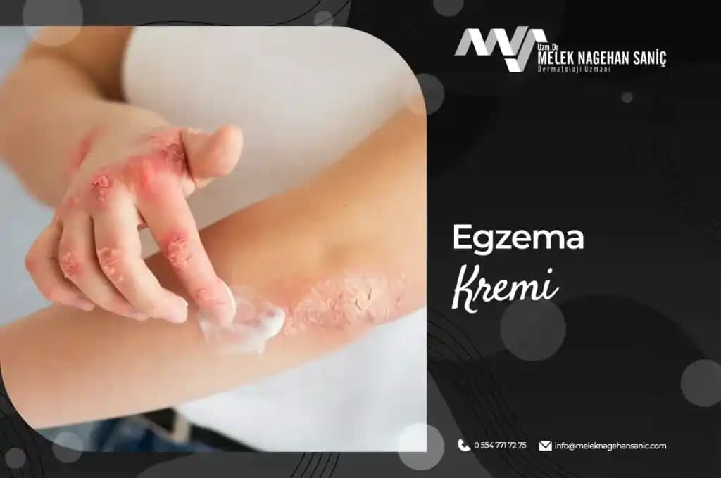 Egzama Kremi Kullanımı ve Dikkat Edilmesi Gerekenler Rehberi