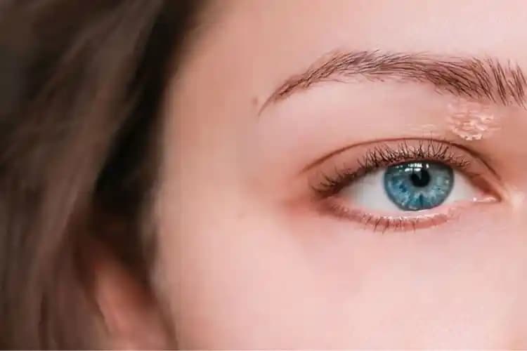 Göz Egzaması İçin Güvenli ve Etkili Cilt Bakım Yöntemleri