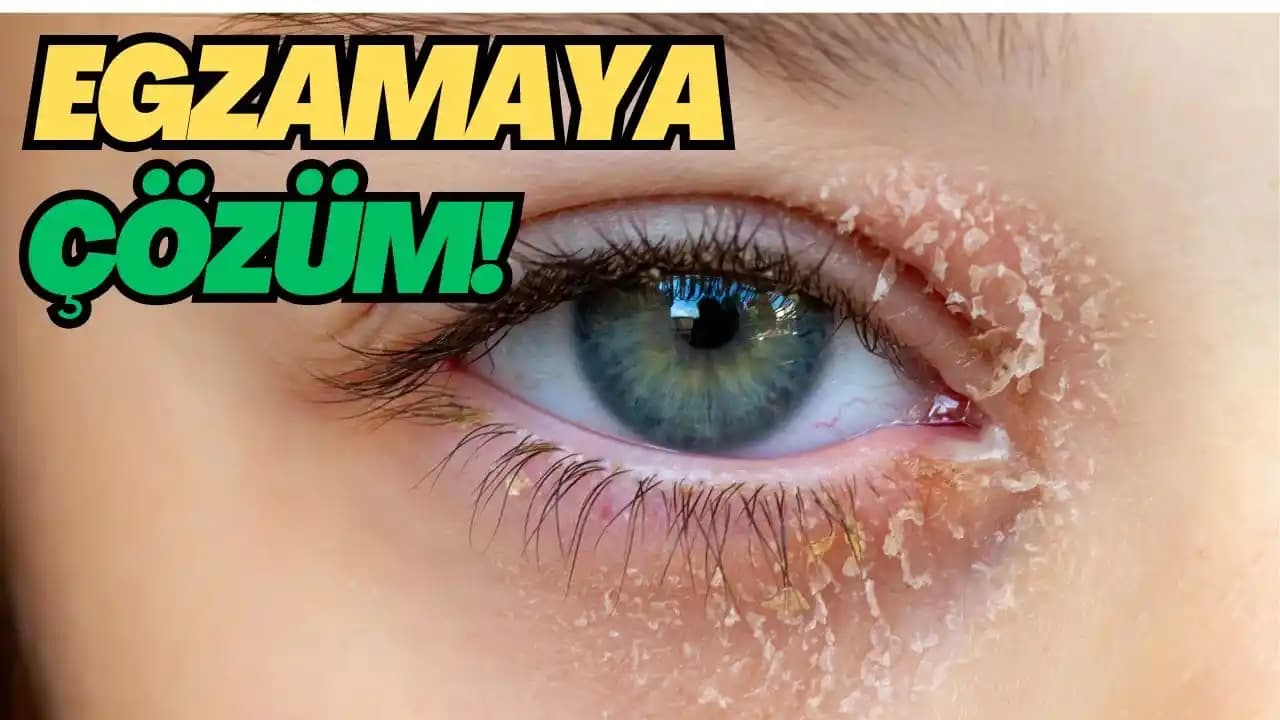 Göz Egzaması İçin Temizlik ve Bakımda 5 Kritik Adım