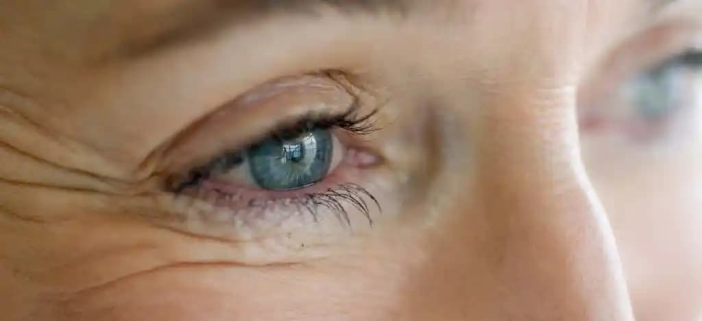 Göz Kırışıklıklarının Nedenleri ve Etkili Bakım Yöntemleri Hakkında Kapsamlı Bilgi