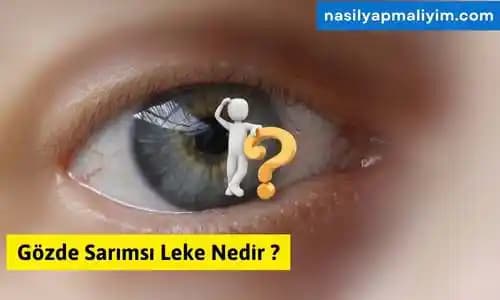 Gözde Leke ve Benleri Önleme Yolları: Cilt Sağlığını Koruma ve Estetik Görünüm