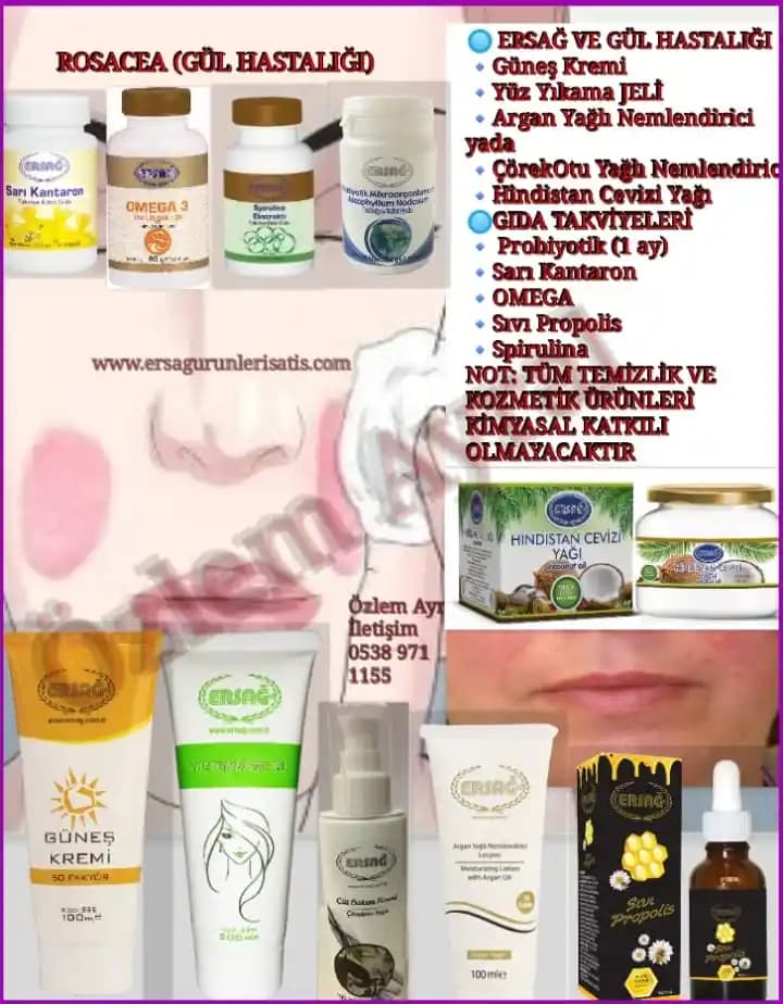 Gül Hastalığında Kozmetik Bakım ve Cilt Sağlığını Koruma Yöntemleri