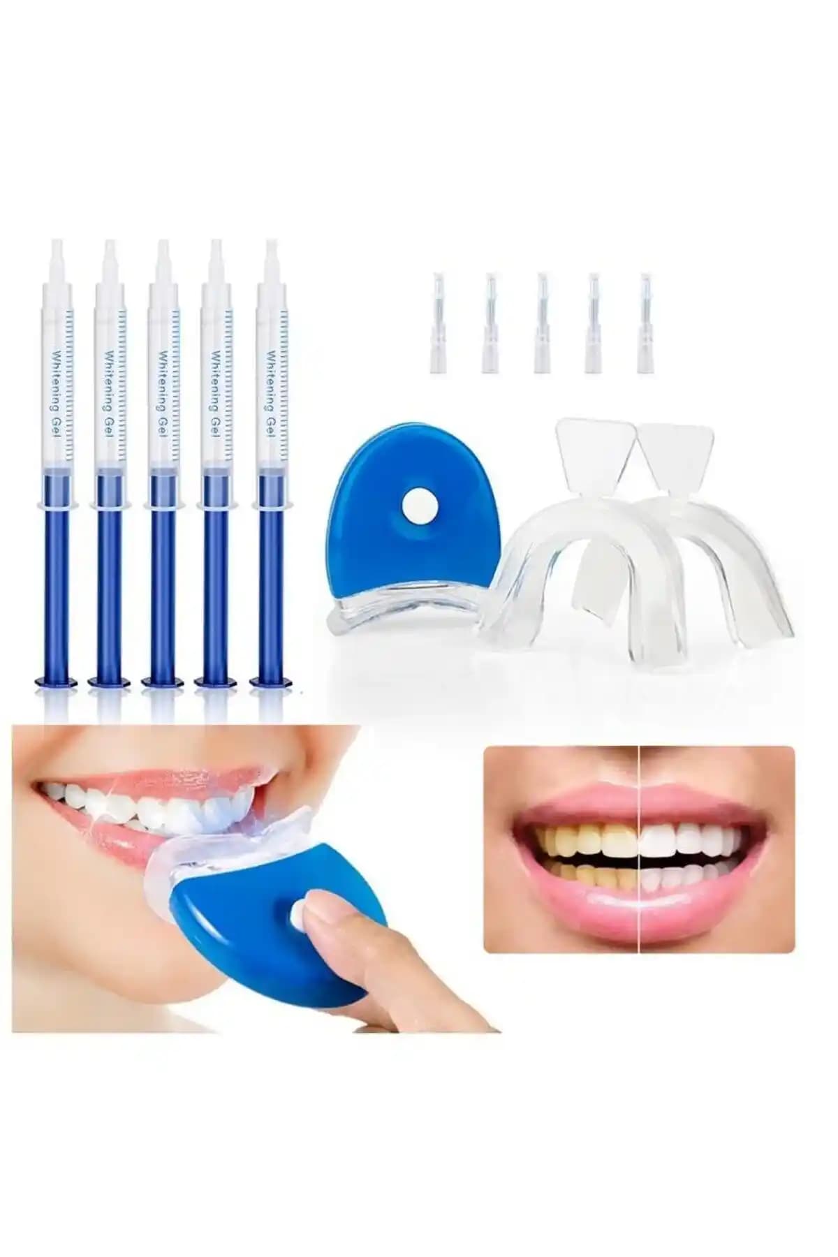 Güvenilir Diş Beyazlatma Setleri ve Parlaklık Sağlama Yöntemleri