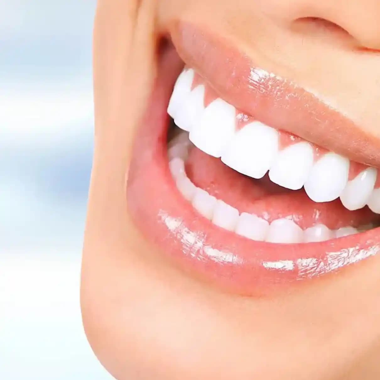 Güvenilir ve Etkili Diş Beyazlatma Yöntemleri Hakkında Bilmeniz Gerekenler