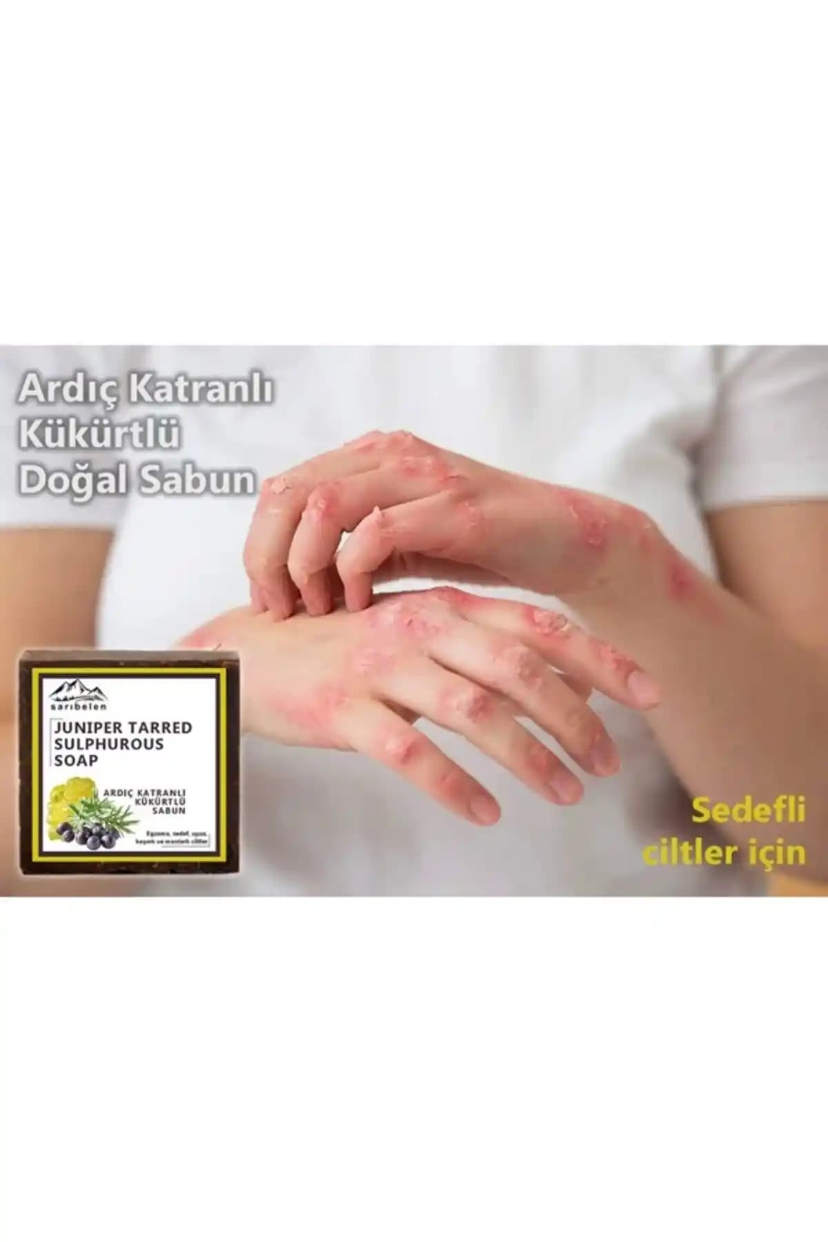 Hanzade Sarıbelen Doğal Kükürtlü Sabun ile Cilt Sağlığında Yeni Yaklaşımlar