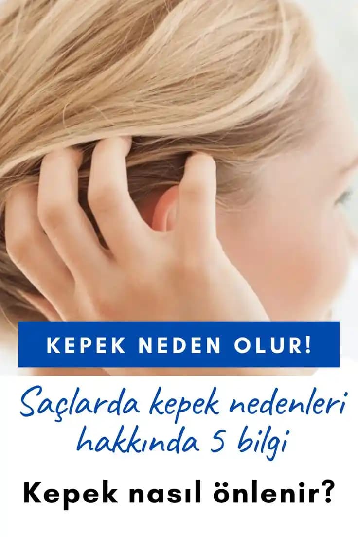 Kepek Nedenleri, Belirtileri ve Etkili Tedavi Yöntemleri Hakkında Kapsamlı Bilgi